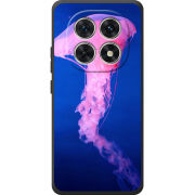 Чохол BoxFace Poco M8 