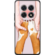 Чохол BoxFace Poco M8 