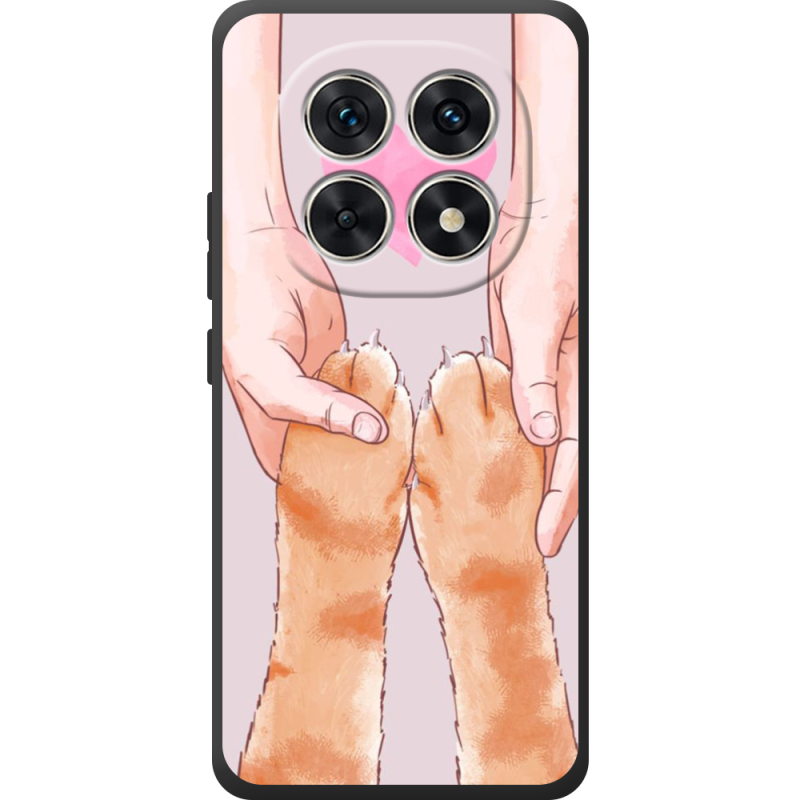 Чохол BoxFace Poco M8 