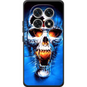 Чохол BoxFace Poco M8 