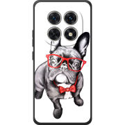 Чохол BoxFace Poco M8 