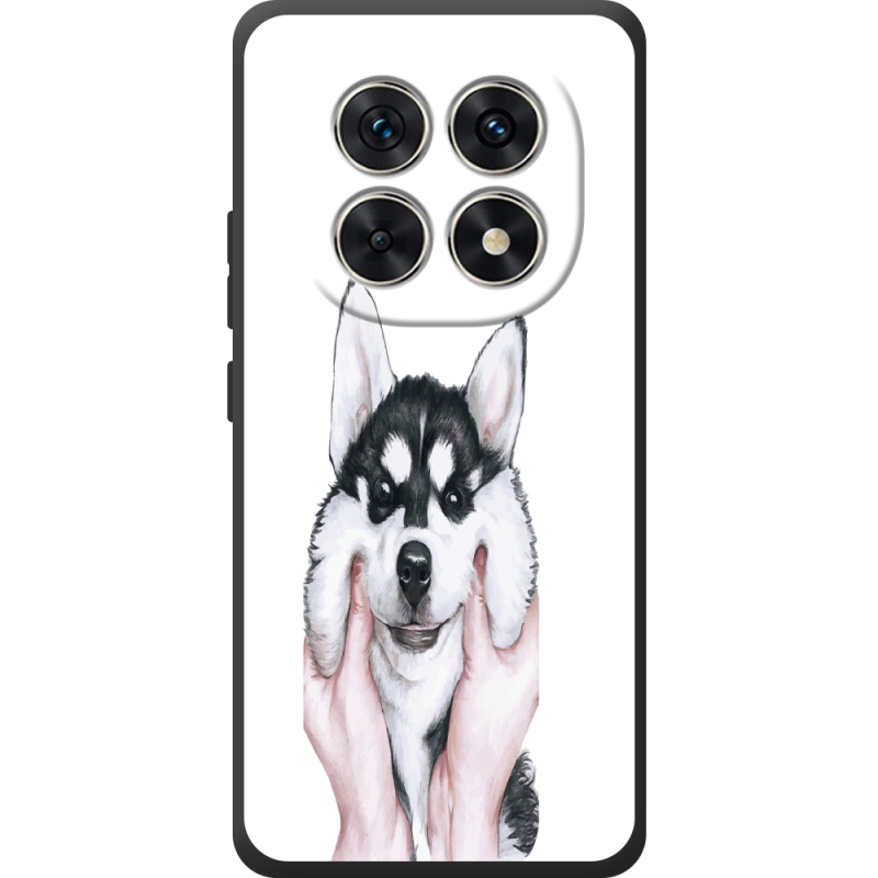 Прозорий чохол BoxFace Poco M8 Husky