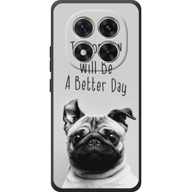 Чохол BoxFace Poco M8 Pro 