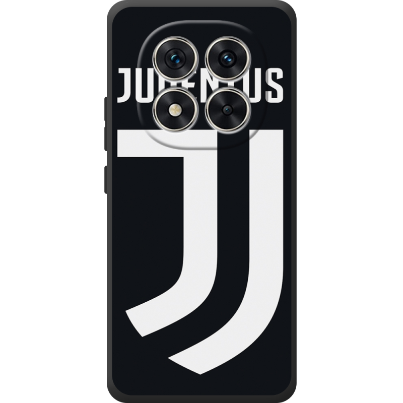 Чохол BoxFace Poco M8 Pro FC J