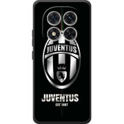 Чохол BoxFace Poco M8 Pro 