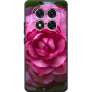 Чохол BoxFace Poco M8 Pro 