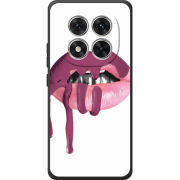 Чохол BoxFace Poco M8 Pro 