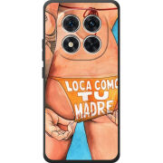 Чохол BoxFace Poco M8 Pro 