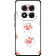 Чохол BoxFace Poco M8 Pro 