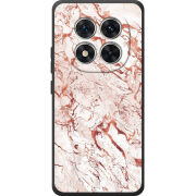 Чохол BoxFace Poco M8 Pro 