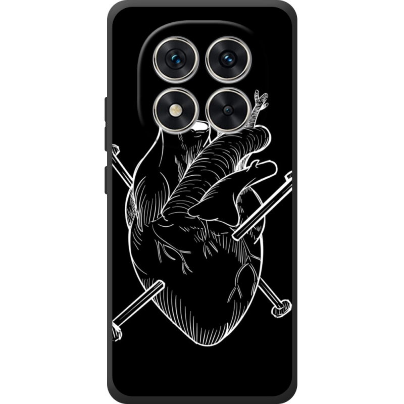 Чохол BoxFace Poco M8 Pro 