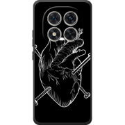 Чохол BoxFace Poco M8 Pro 