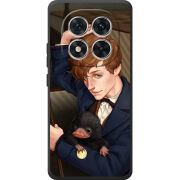 Чохол BoxFace Poco M8 Pro 