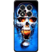 Чохол BoxFace Poco M8 Pro 