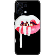 Чохол BoxFace OPPO A6 Pro 