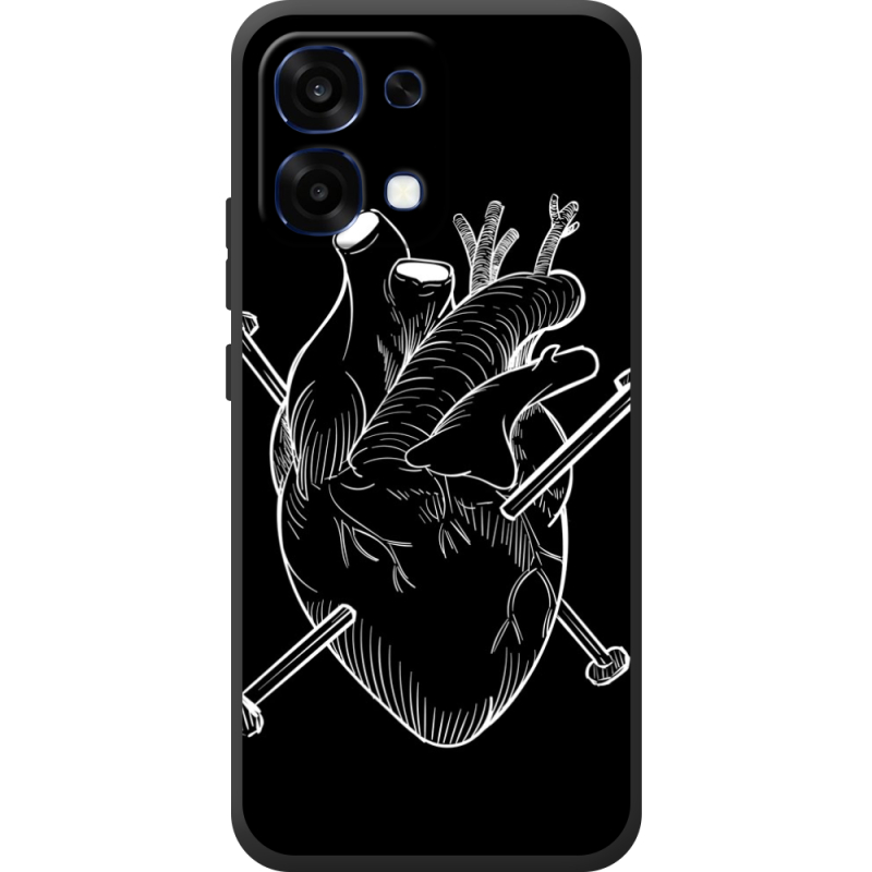 Чохол BoxFace OPPO A6 Pro 