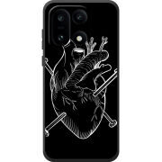 Чохол BoxFace OnePlus 15 