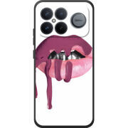 Чохол BoxFace Poco F8 Ultra 