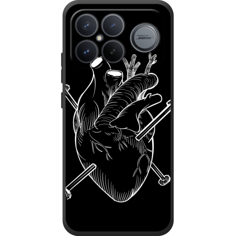 Чохол BoxFace Poco F8 Ultra 