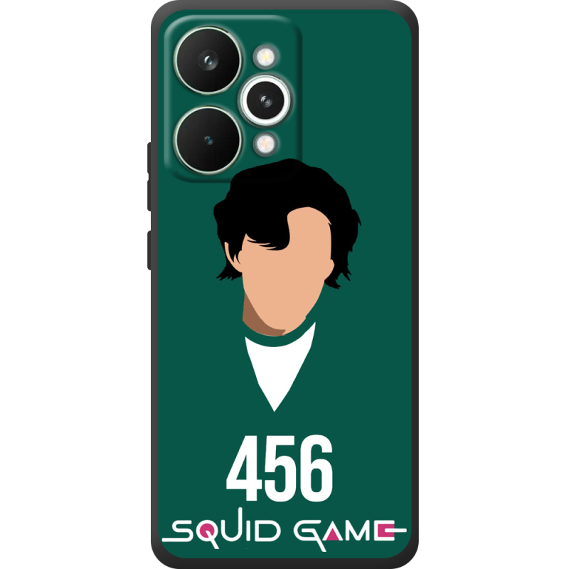 Чохол BoxFace Realme 15 Pro siquid game 456