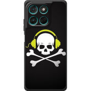 Чохол BoxFace Moto G86 Power 