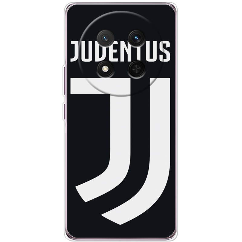 Чохол BoxFace Honor X9c FC J