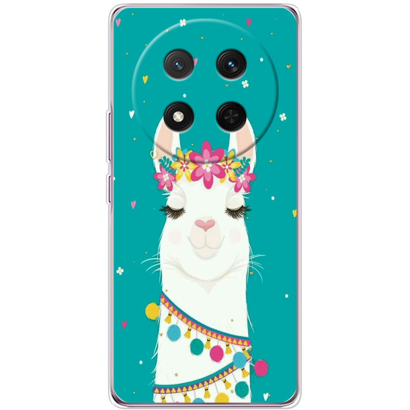 Чохол BoxFace Honor X9c Cold Llama