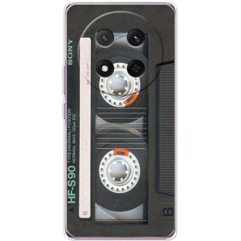 Чохол BoxFace Honor X9c Старая касета