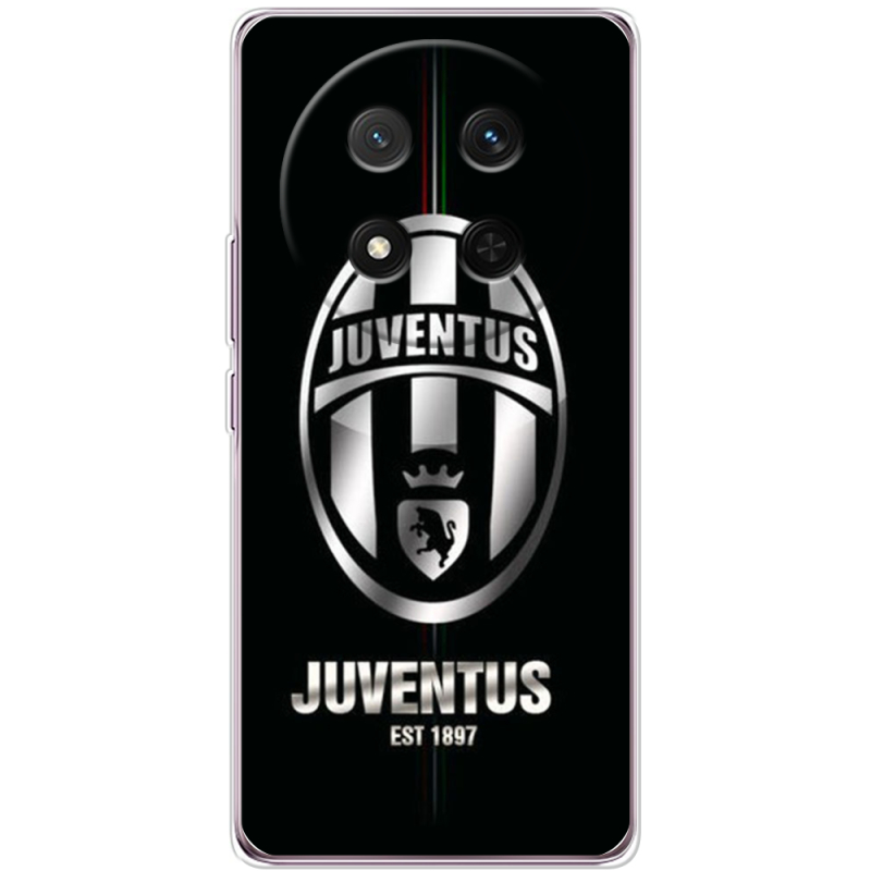 Чохол BoxFace Honor X9c 