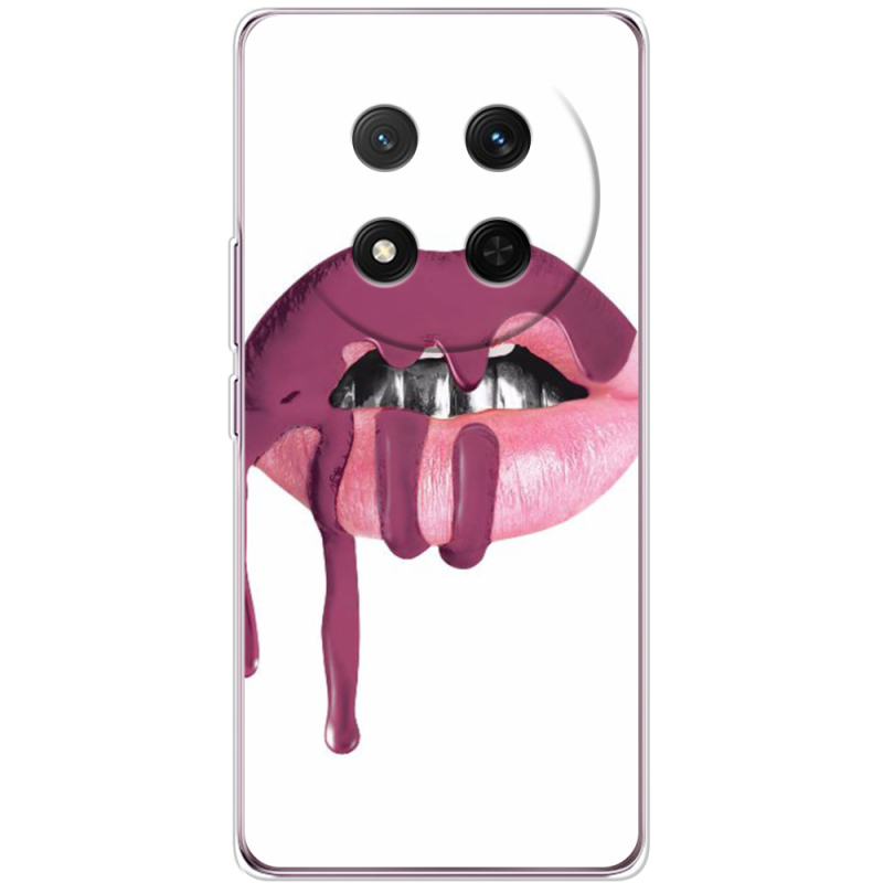 Чохол BoxFace Honor X9c 