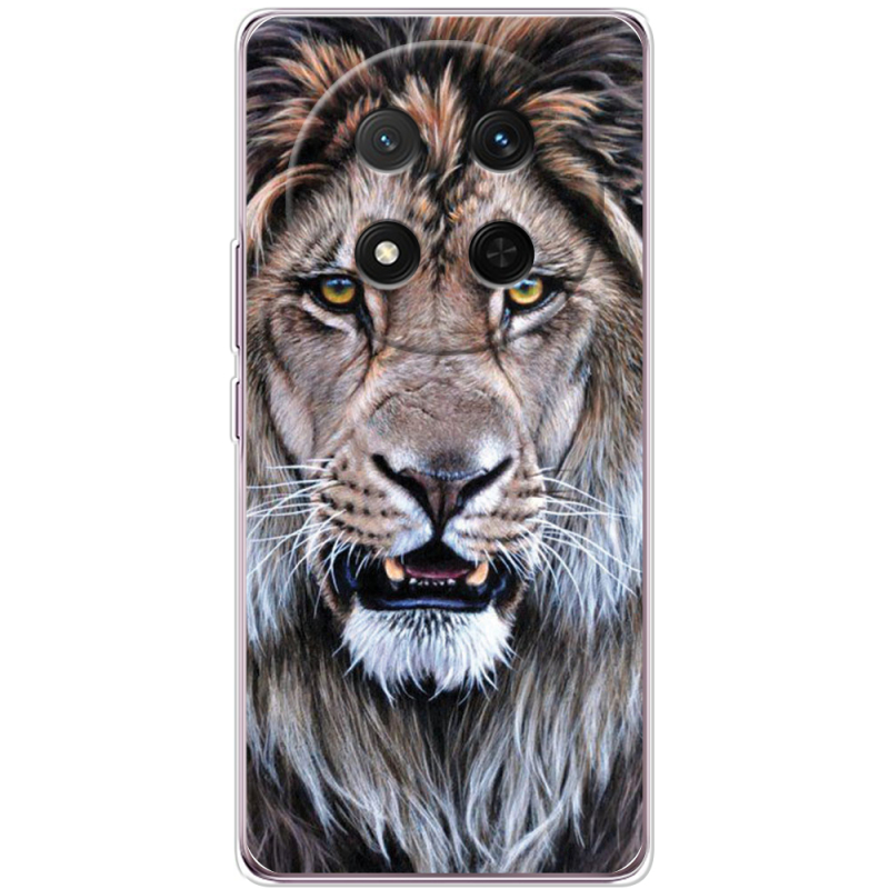 Чохол BoxFace Honor X9c 