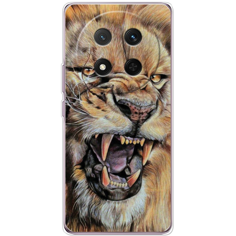 Чохол BoxFace Honor X9c 