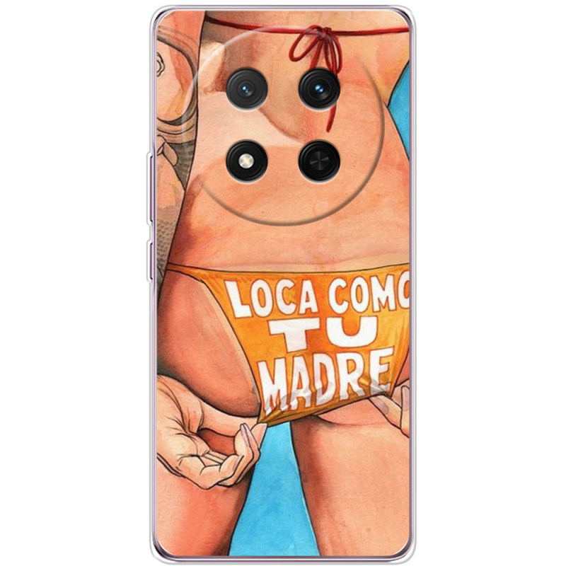 Чохол BoxFace Honor X9c 