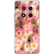 Чохол BoxFace Honor X9c 