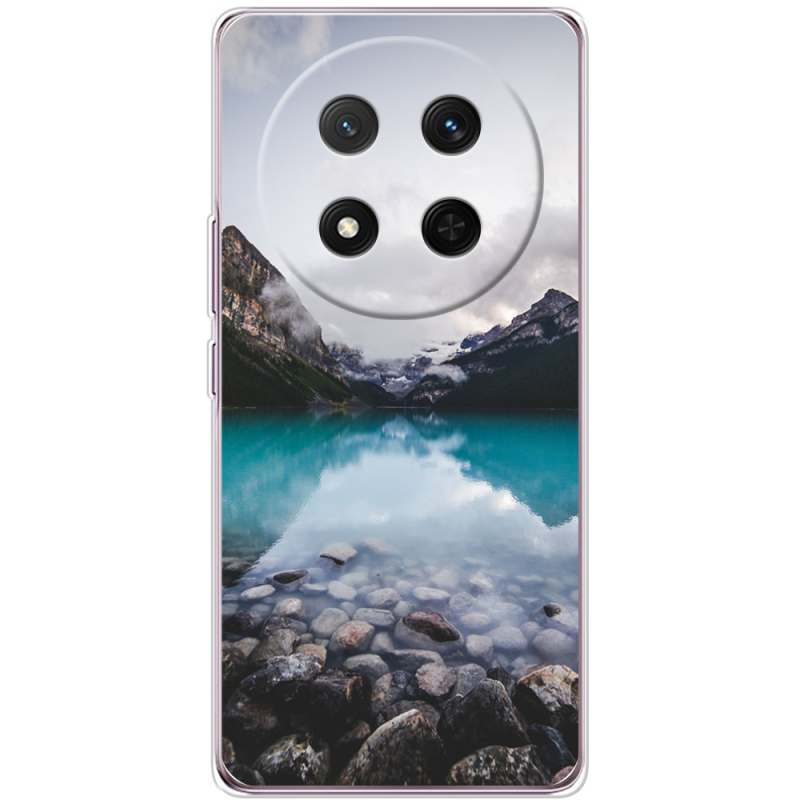 Чохол BoxFace Honor X9c 