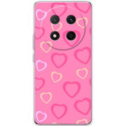 Чохол BoxFace Honor X9c Sugar Hearts