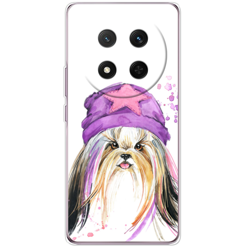 Чохол BoxFace Honor X9c 