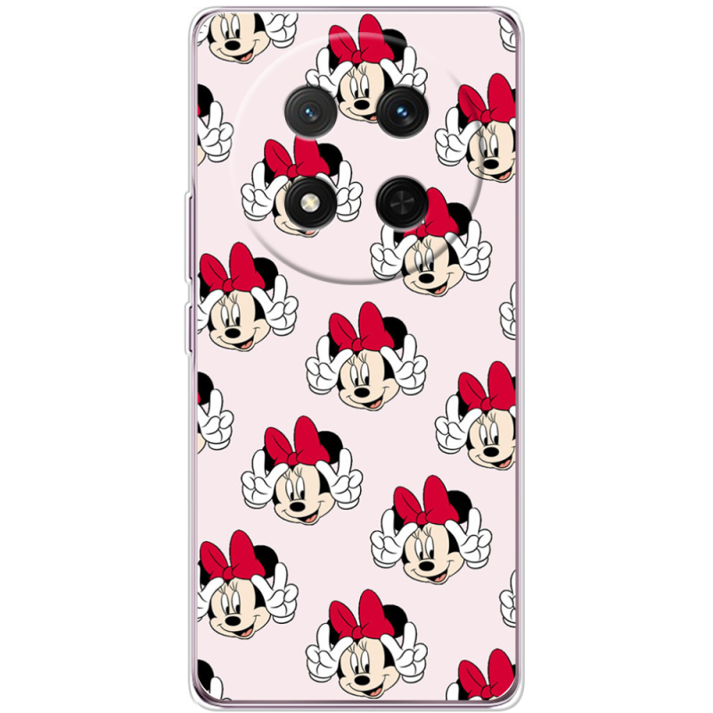 Чохол BoxFace Honor X9c 