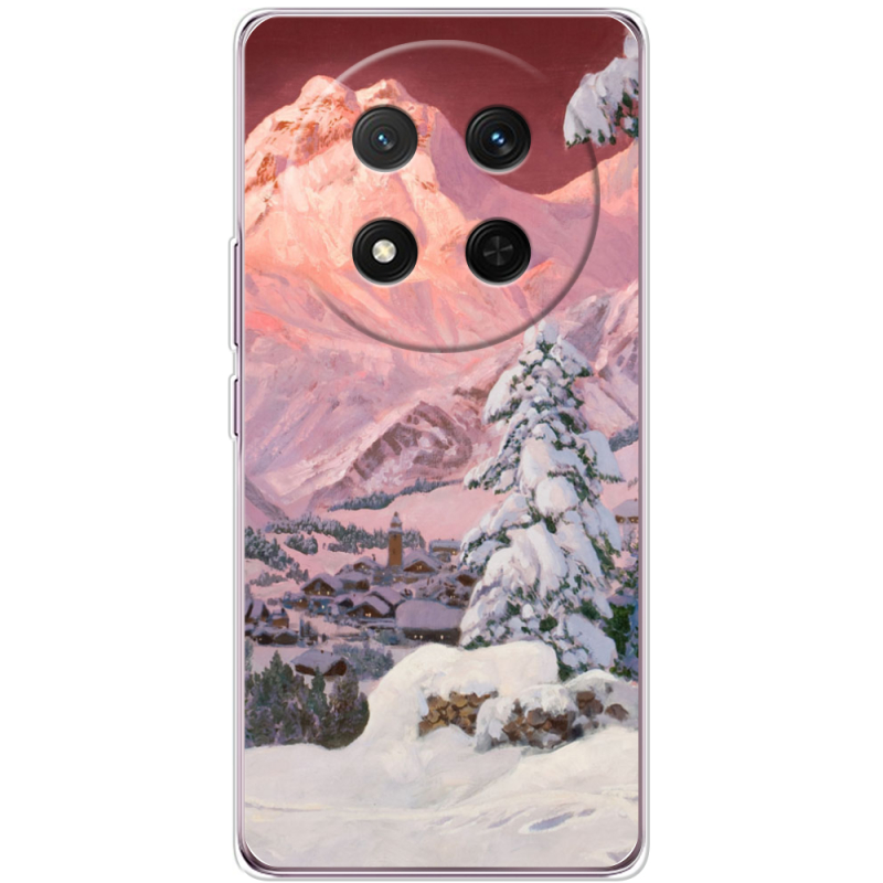 Чохол BoxFace Honor X9c 