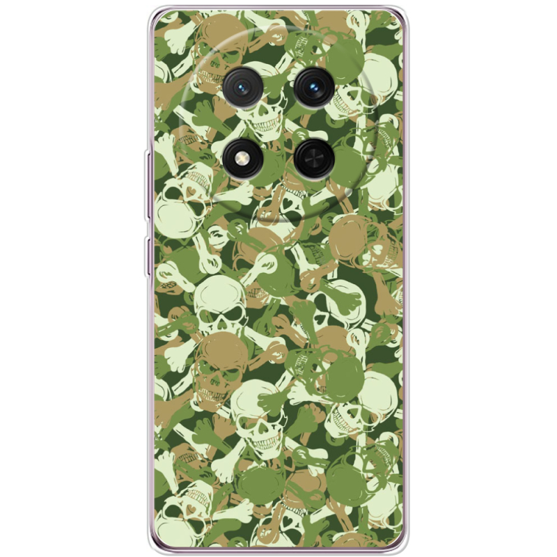 Чохол BoxFace Honor X9c 