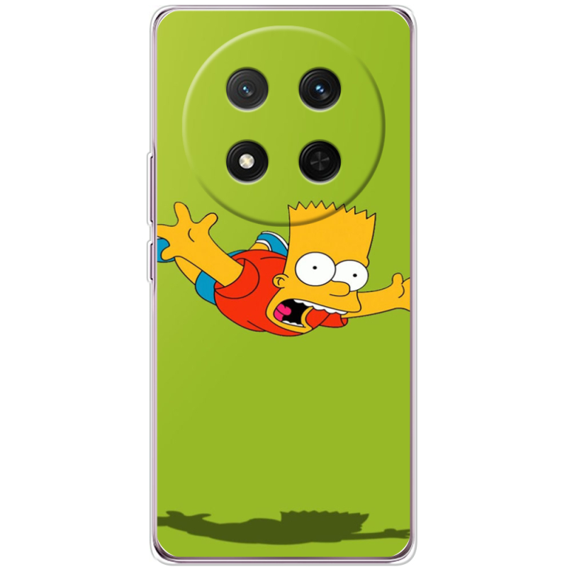 Чохол BoxFace Honor X9c 