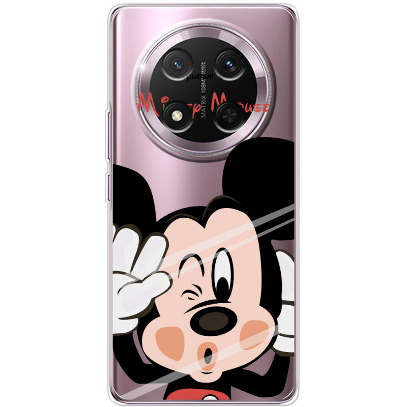 Прозорий чохол BoxFace Honor X9c Mister M