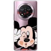 Прозорий чохол BoxFace Honor X9c Mister M