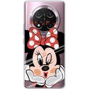 Прозорий чохол BoxFace Honor X9c Lady M