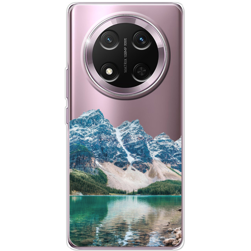 Прозорий чохол BoxFace Honor X9c Blue Mountain