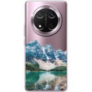 Прозорий чохол BoxFace Honor X9c Blue Mountain