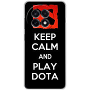 Чохол BoxFace OnePlus Ace 5 