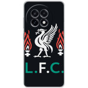 Чохол BoxFace OnePlus Ace 5 L. F. C.