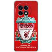 Чохол BoxFace OnePlus Ace 5 