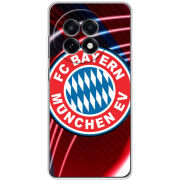 Чохол BoxFace OnePlus Ace 5 